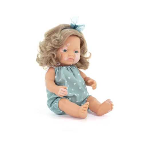 My Friends & Me Baby Doll, Caucasian Girl With Vitiligo, 15